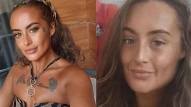 Mujer muere tras ser mordida por perro durante pelea por nuggets de pollo en Inglaterra