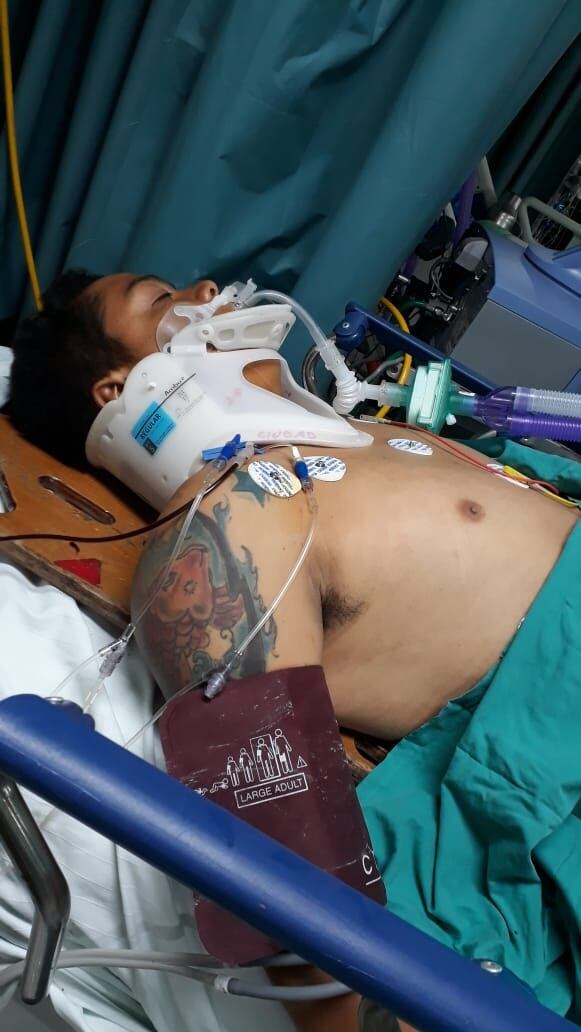 José Rojas Aguirre, joven que perdió las piernas en accidente con camión de basura. Foto cortesía José Rojas.