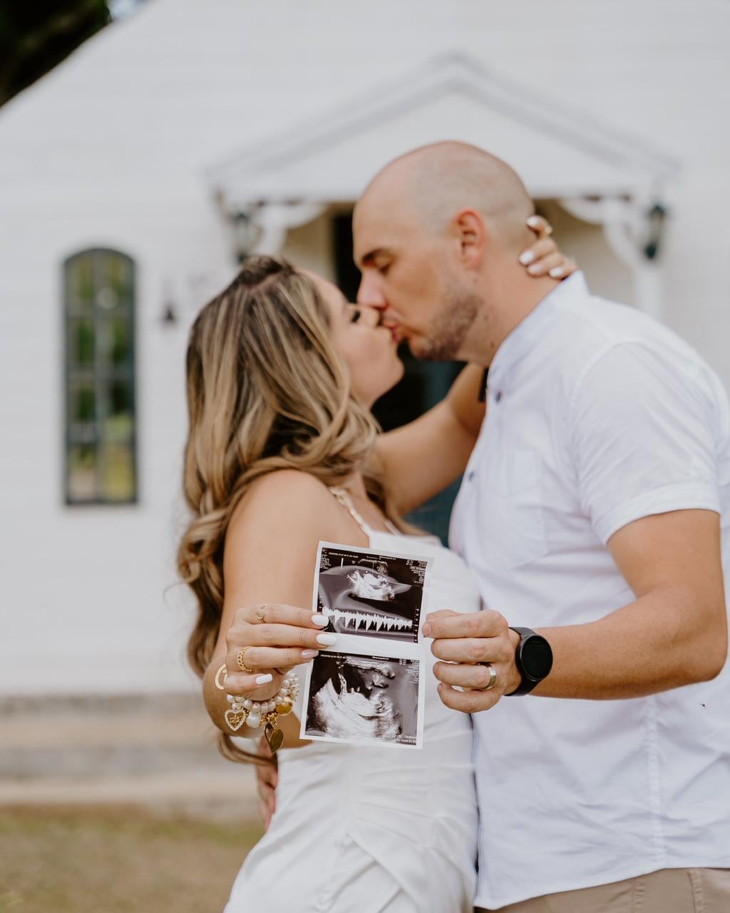 Tracy Calvo le propuso, en junio del 2020, matrimonio a su esposo, Fabricio Gamboa, mientras él estaba internado por cáncer en el Calderón Guardia, él falleció y ella entre 2025 y 2026 escribió un libro con la historia que vivieron juntos. "Amé hasta el cielo", es el título.