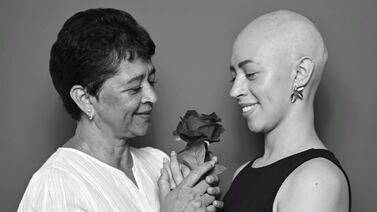Sobrevivientes de cáncer de mama protagonizan una emotiva muestra de fotos