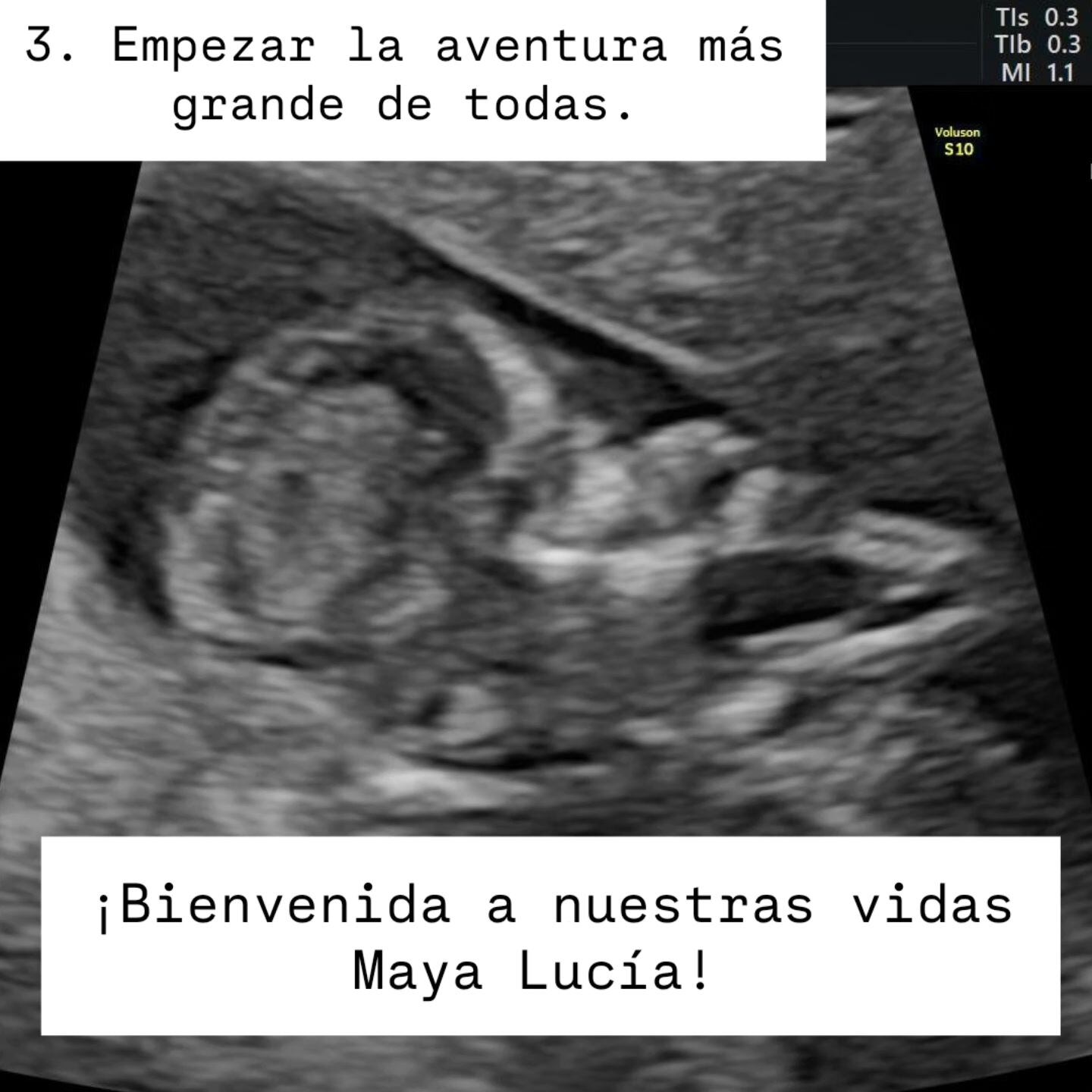 María Torres vivirá este 2025 un momento muy emocionante y tierno ya que se convertirá en abuela, por primera vez, a sus 65 años.