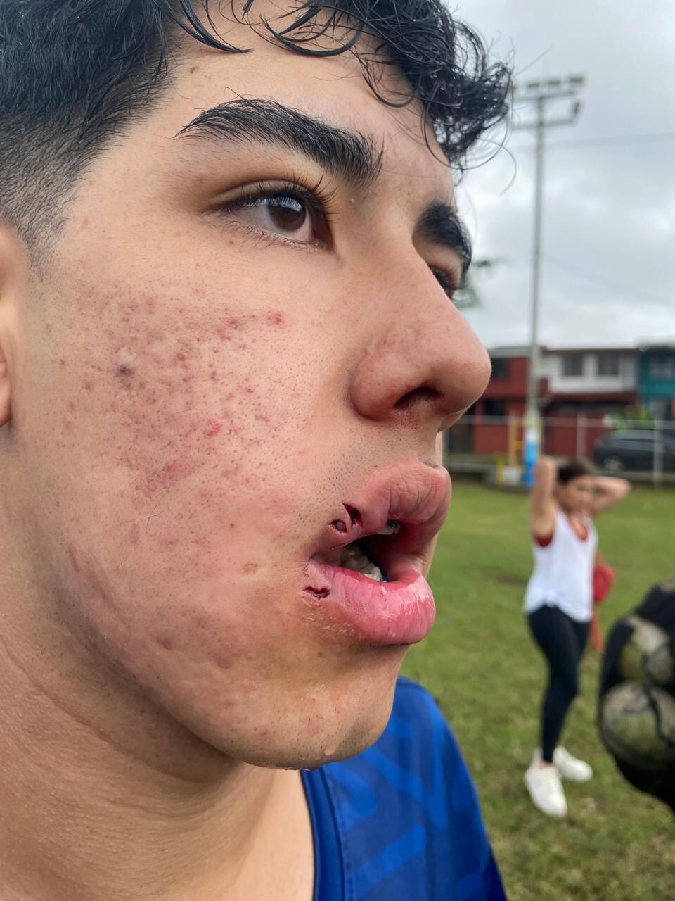 Trifulca en Linafa, Atlético Junior vs Afiv, u20