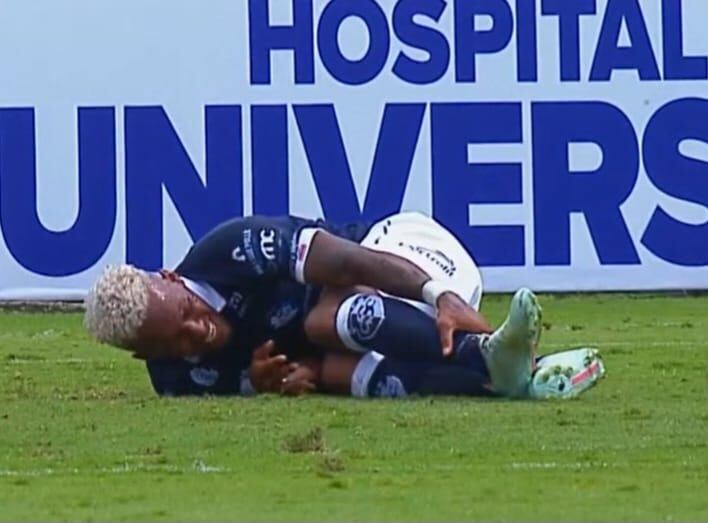 El tobillo de Jeikel Venegas se giró por completo. El delantero del Cartaginés no paraba de gritar por el dolor que le generó la acción ante el Santos, en la fecha dos del Torneo de Apertura 2024.
