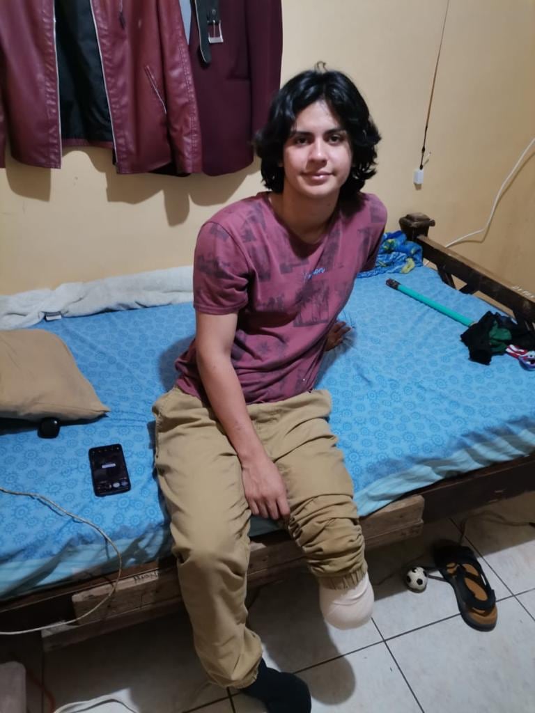 Derek obando sobreviviente a balacera y amputado