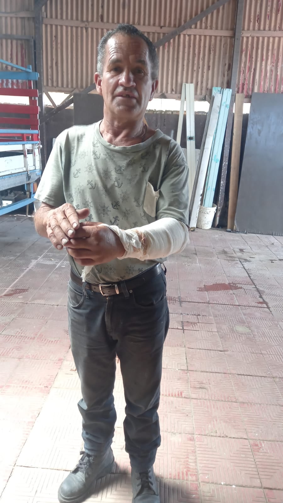 Don Carlos sufrió heridas en su brazo izquierdo debido al accidente. Foto cortesía.