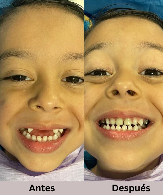 Ezequiel recuperó la sonrisa para vivir una feliz Navidad