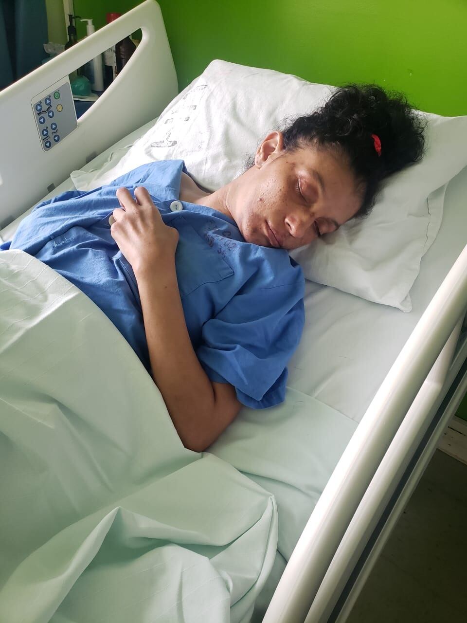 Sandra Hernández, corredora que quedó en condición grave luego de ser atropellada por un carro cuando entrenaba. Foto cortesía Erick Siles.