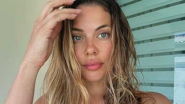 Laura Ortega habla sin tapujos de su cambio físico y la obsesión con sus labios