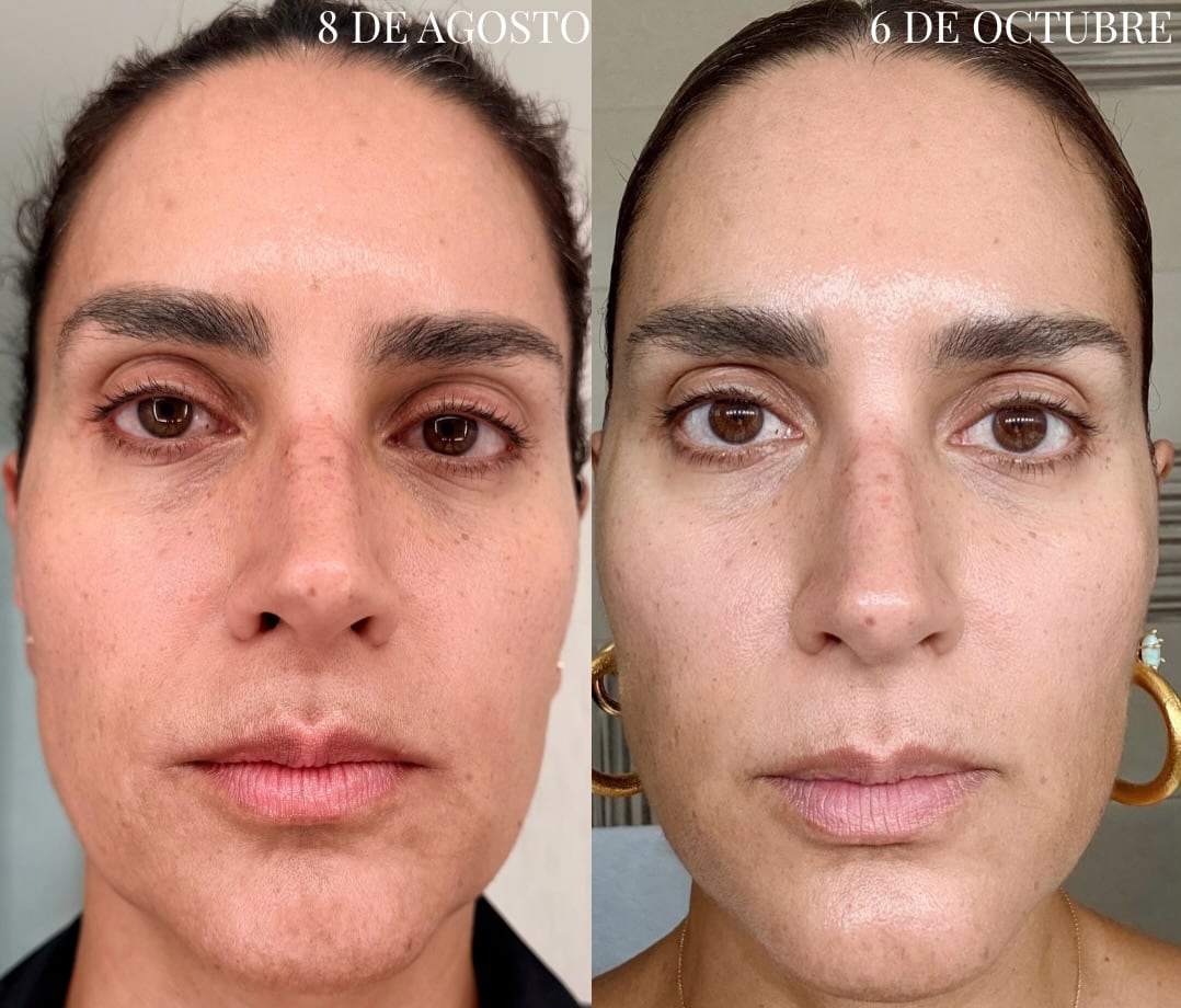 Catalina Mendieta
