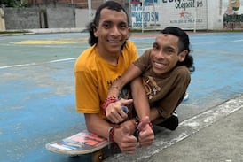 Gemelos siameses murieron con minutos de diferencia: esto les pasó a los 27 años
