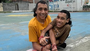 Gemelos siameses murieron con minutos de diferencia: esto les pasó a los 27 años