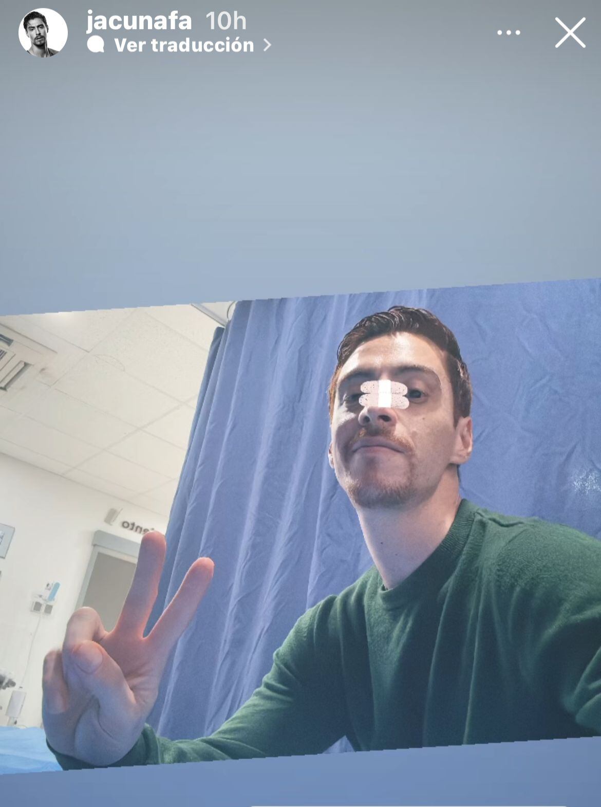 Javier Acuña se fracturó la nariz en el ensayo de MQB