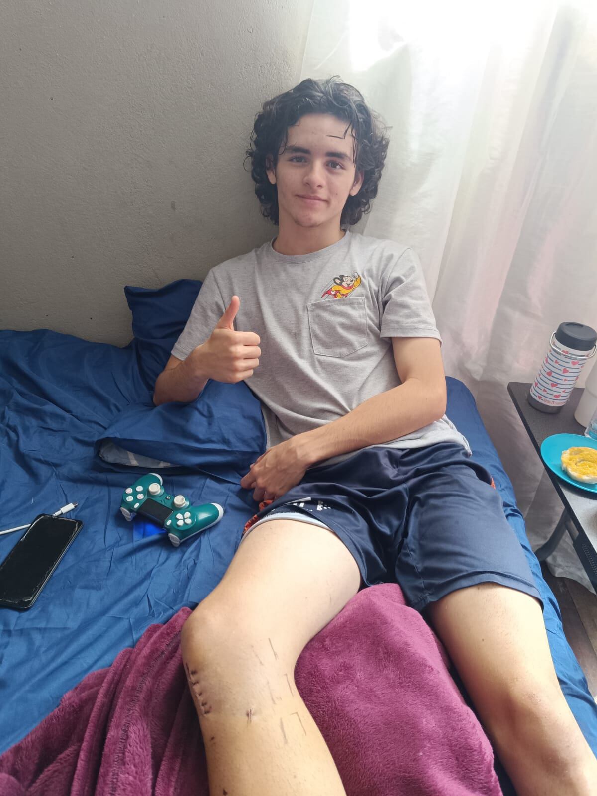 Ignacio Araya, Nacho, jugador de Ramonense, fractura tibia y peroné