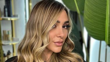 Modelo tica contó que comenzó a retomar su vida tras sufrir un accidente montando un caballo