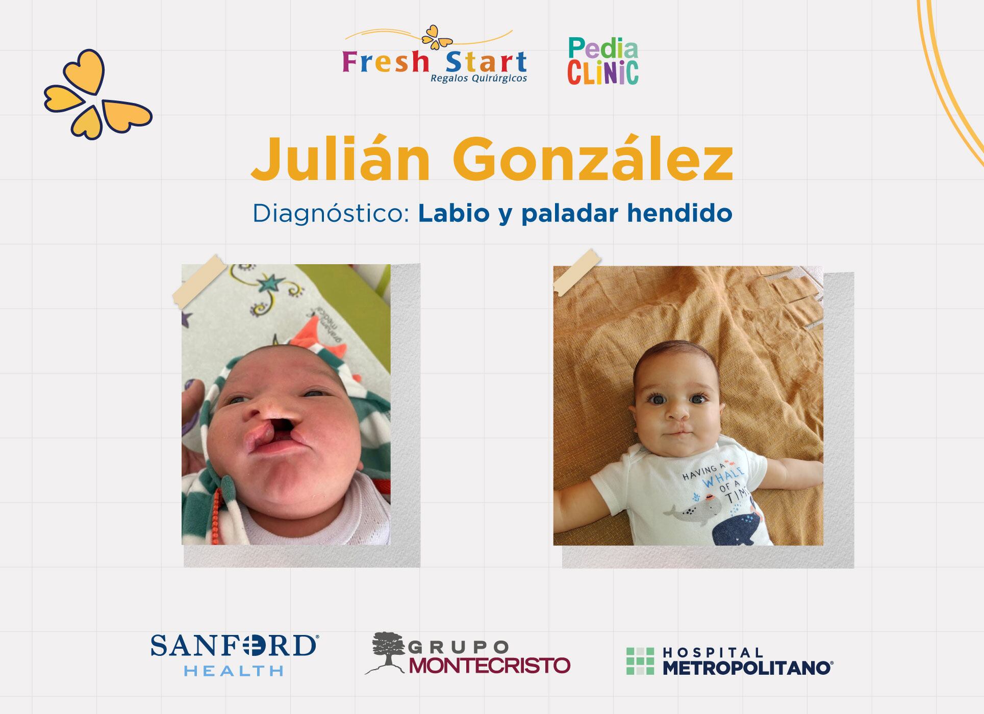 Buscando darle una oportunidad a estos niños y jóvenes la Fundación Fresh Start en unión con el Hospital Metropolitano, PediaClinic y Sanford Health, anuncia el regreso de un programa que permitirá que más niños costarricenses puedan acceder a cirugías reconstructivas gratuitas en Estados Unidos.