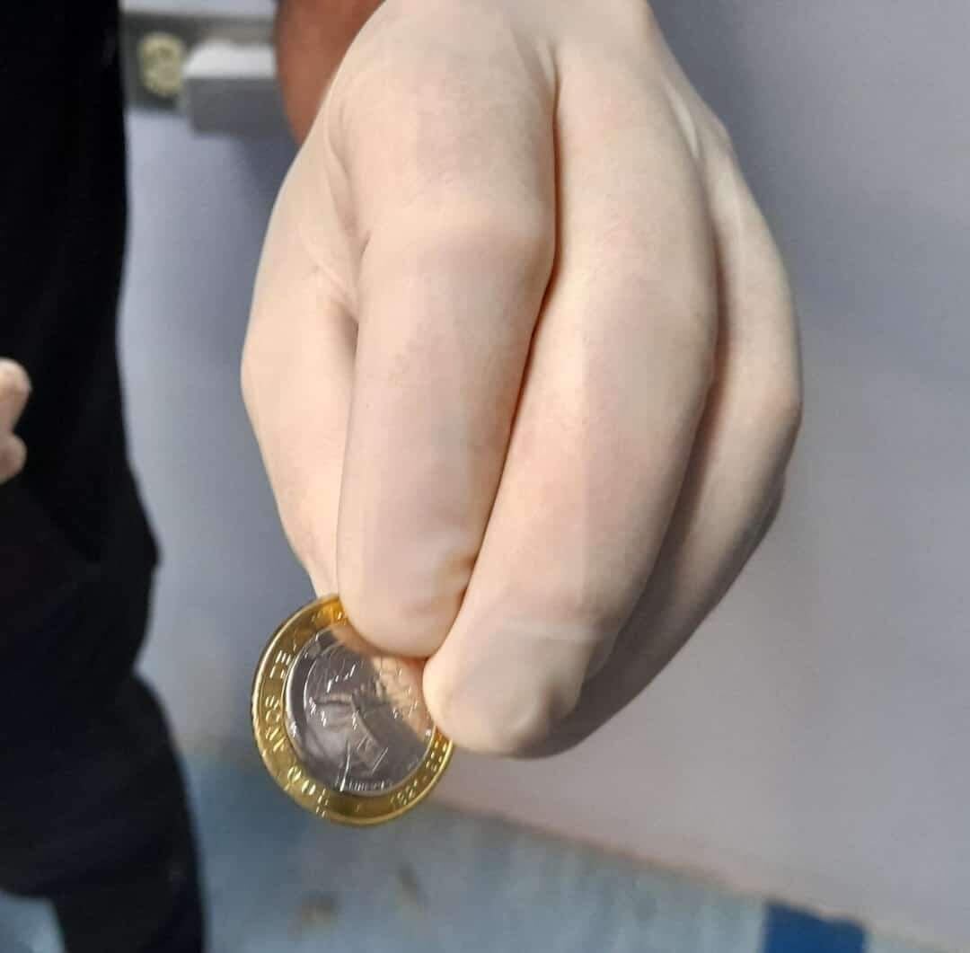 Monedas desviaban bala que iba a impactar pierna izquierda de repartidor de comida. Foto suministrada por Keyna Calderón.