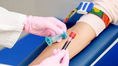 ¿Cómo bajar los triglicéridos? Le damos prácticos consejos para lograrlo