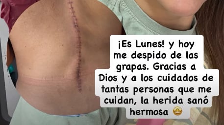 Ginnés Rodríguez y su operación en la columna.