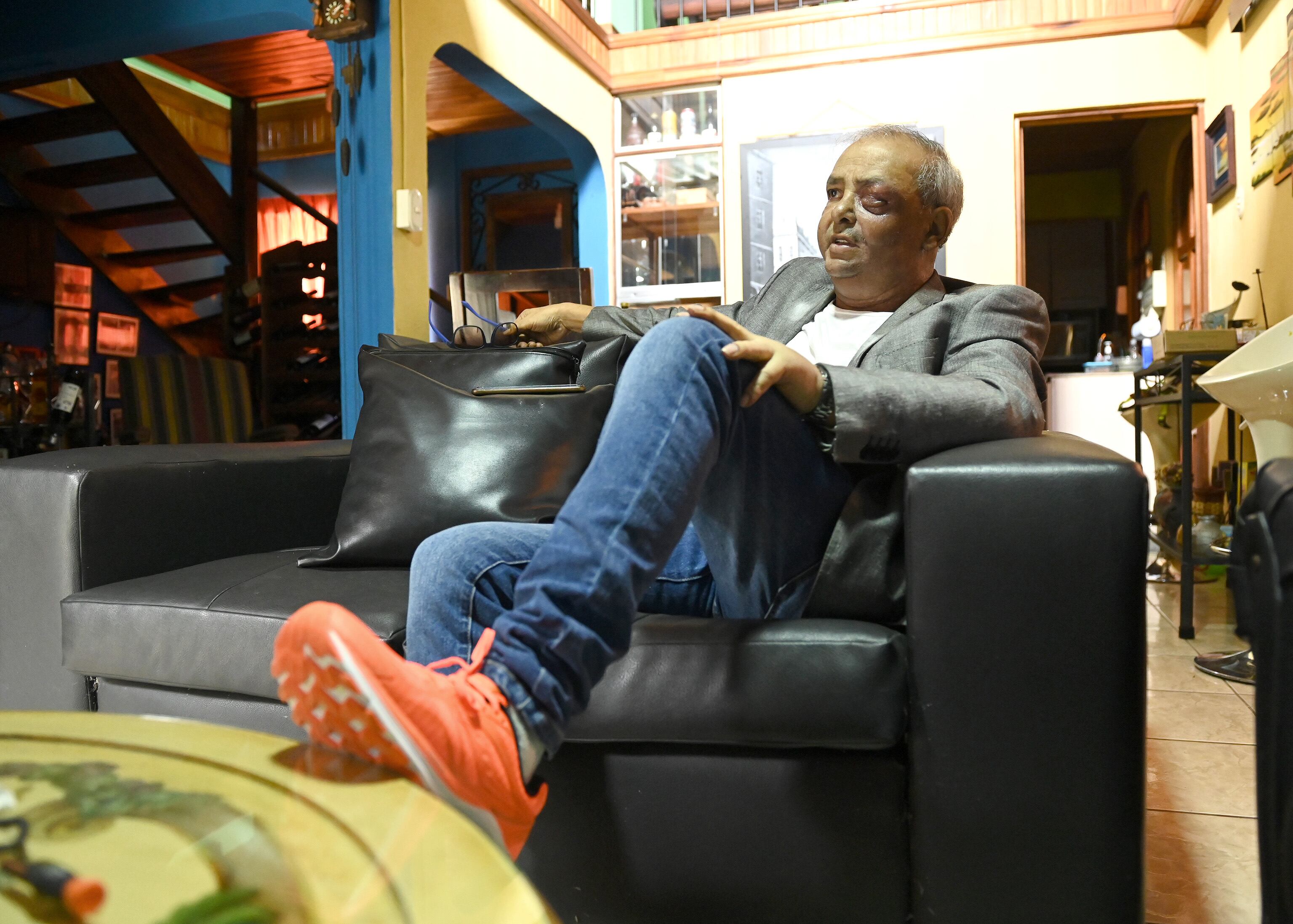 Ramón Luis Méndez se recupera de la radioterapia