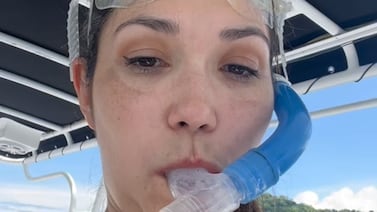 Ginnés Rodríguez confiesa batalla que libra por enfermedad que afecta su rostro