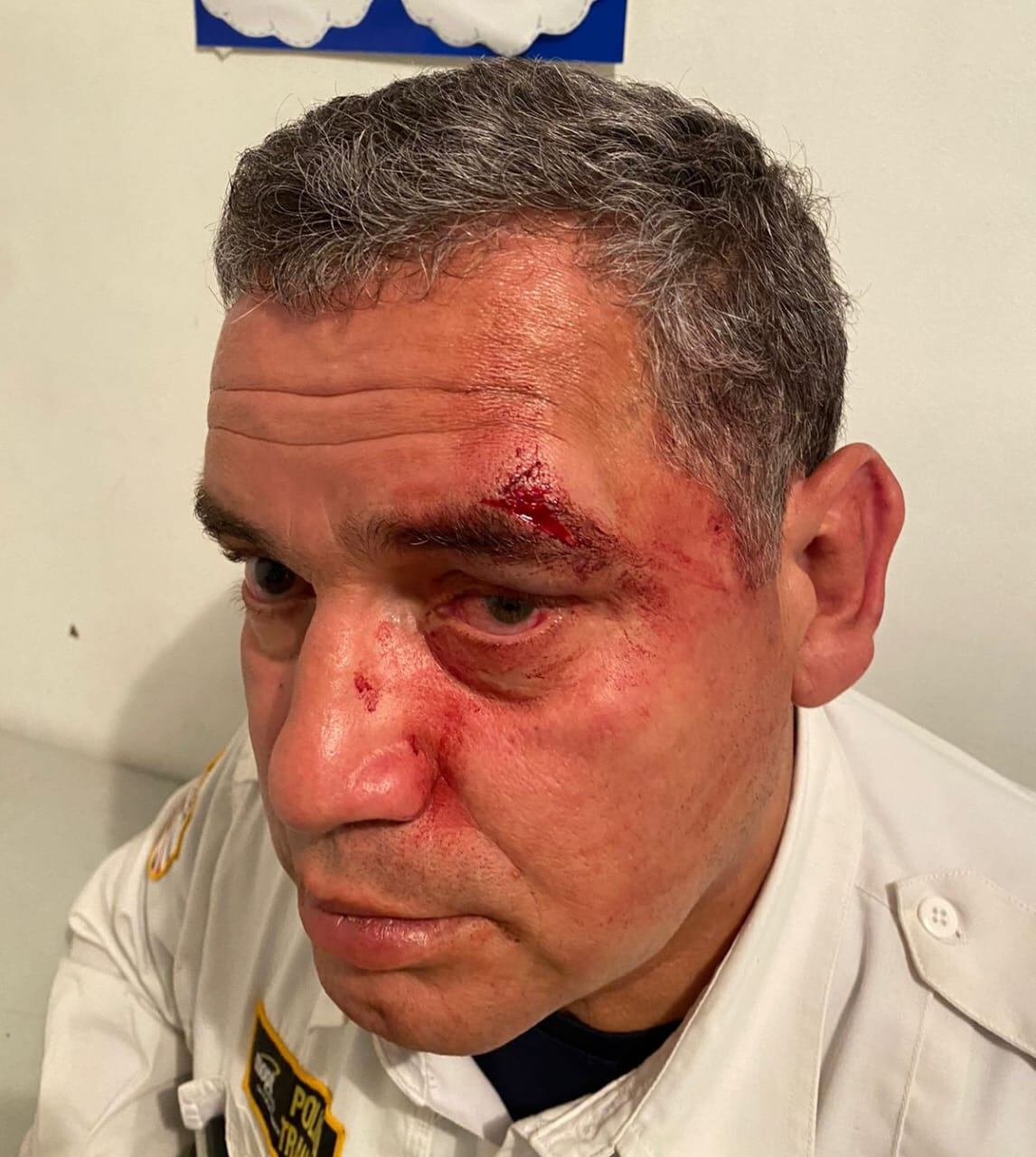 El oficial Luis Martínez Sanabria recibió una patada en la ceja. Foto: Keyna Calderón