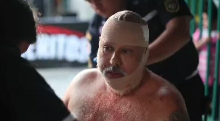 Christian Castro, un aficionado de Alajuelense denunció ser agredido por seguidores del Comunicaciones. Instagram.