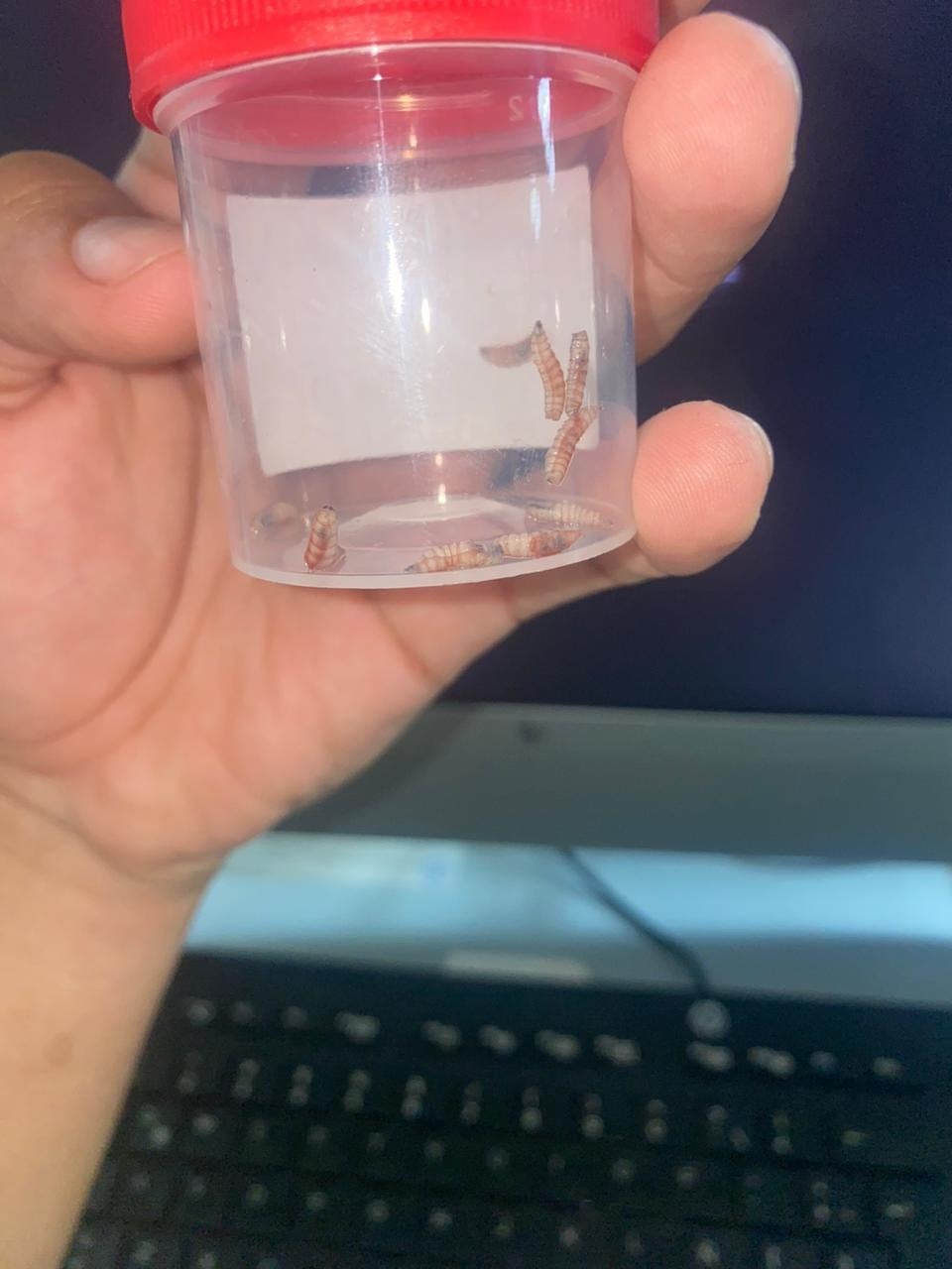 El gusano barrenador se confirmó en la boca de una muchacha de 19 años de Río Naranjo de Bagaces en Guanacaste, la hermana, Vanessa Rojas Murillo, cuenta el calvario que vivieron en centros médicos de la Caja para que la atendieran.