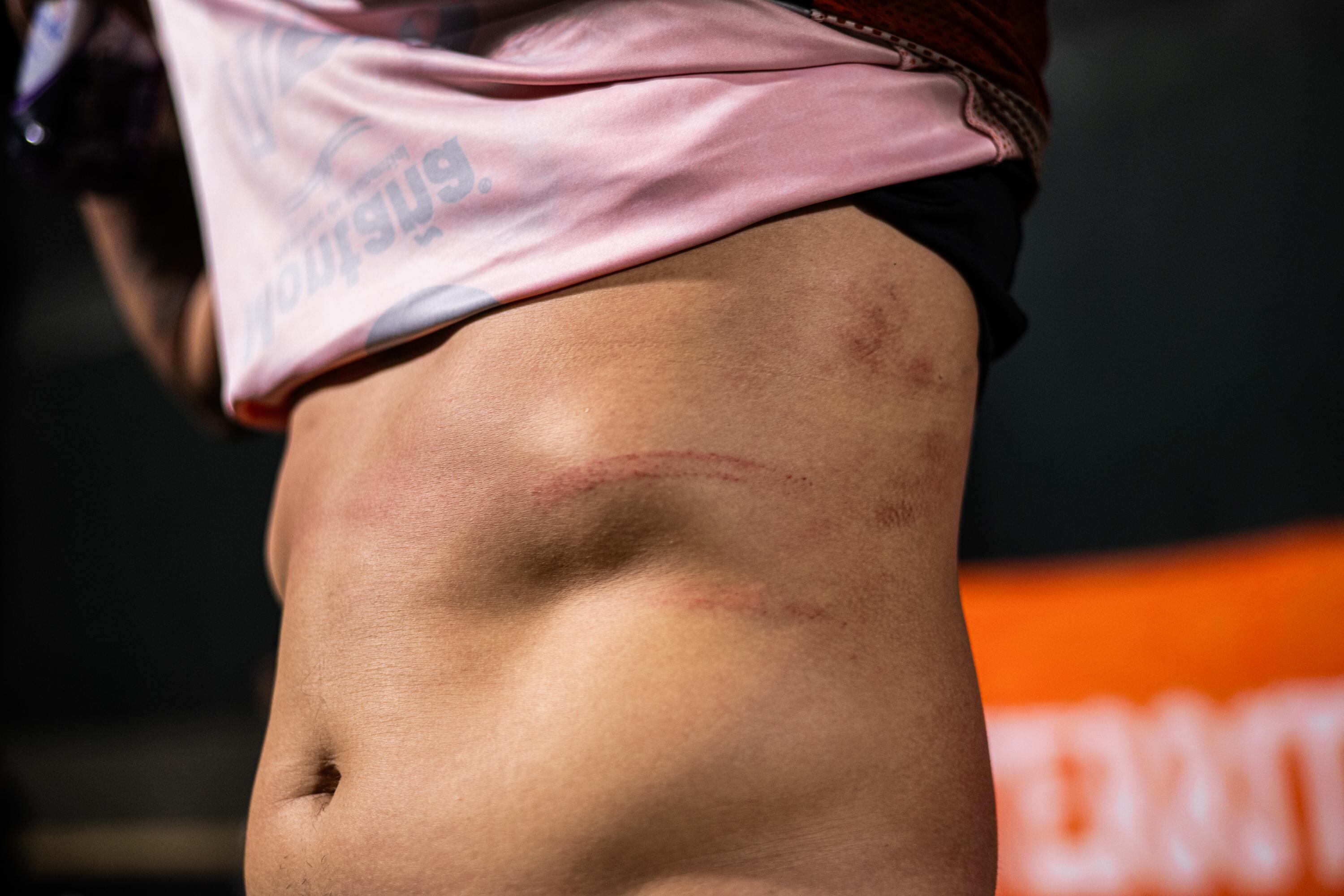 Miguel Sansores y los pellizcos que le dieron los jugadores de Alajuelense