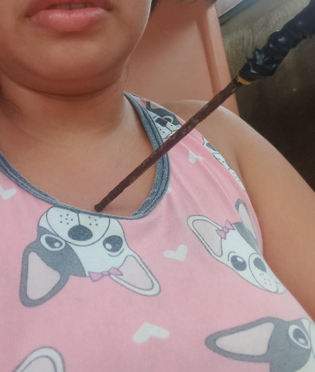 Joven mamá es atacada y le clavan varilla en el pecho. Foto cortesía Allison Jiménez.