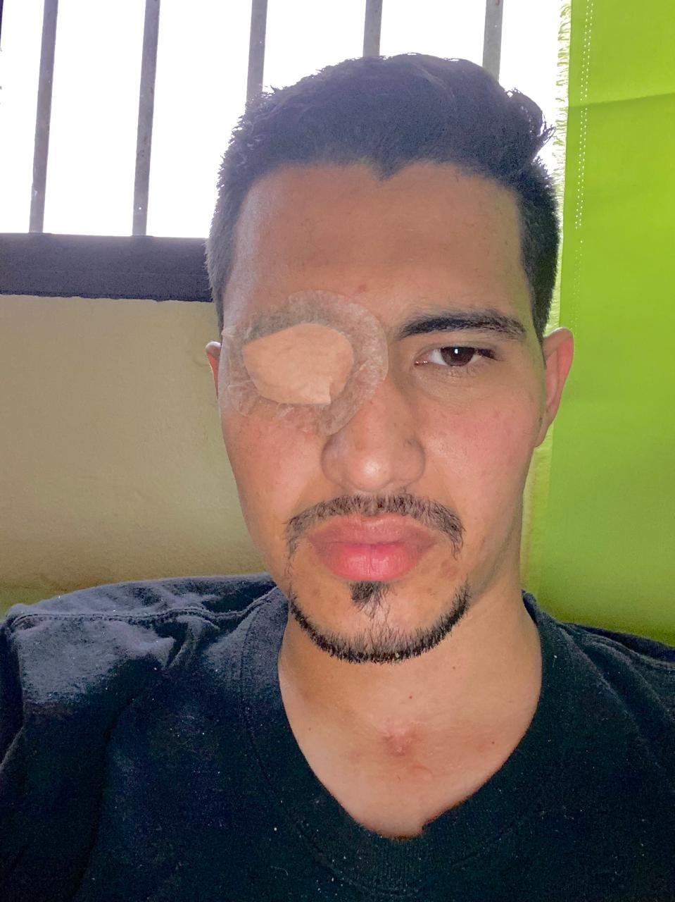 Norman Aguilar Castro en un joven de 29 años padece el padece el síndrome Von hippel lindau