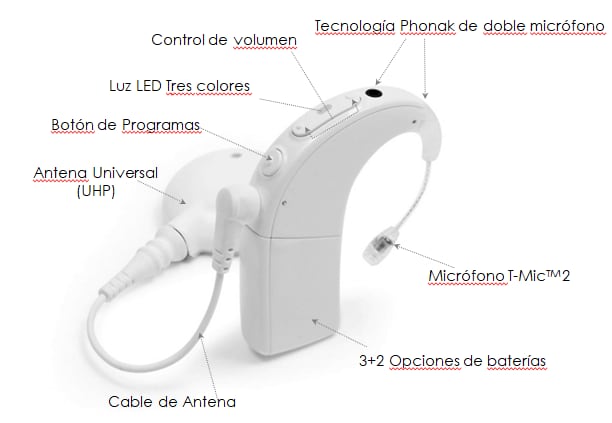 Estas son las partes de un tipo de procesador de sonido que utiliza una persona sorda con implante coclear.