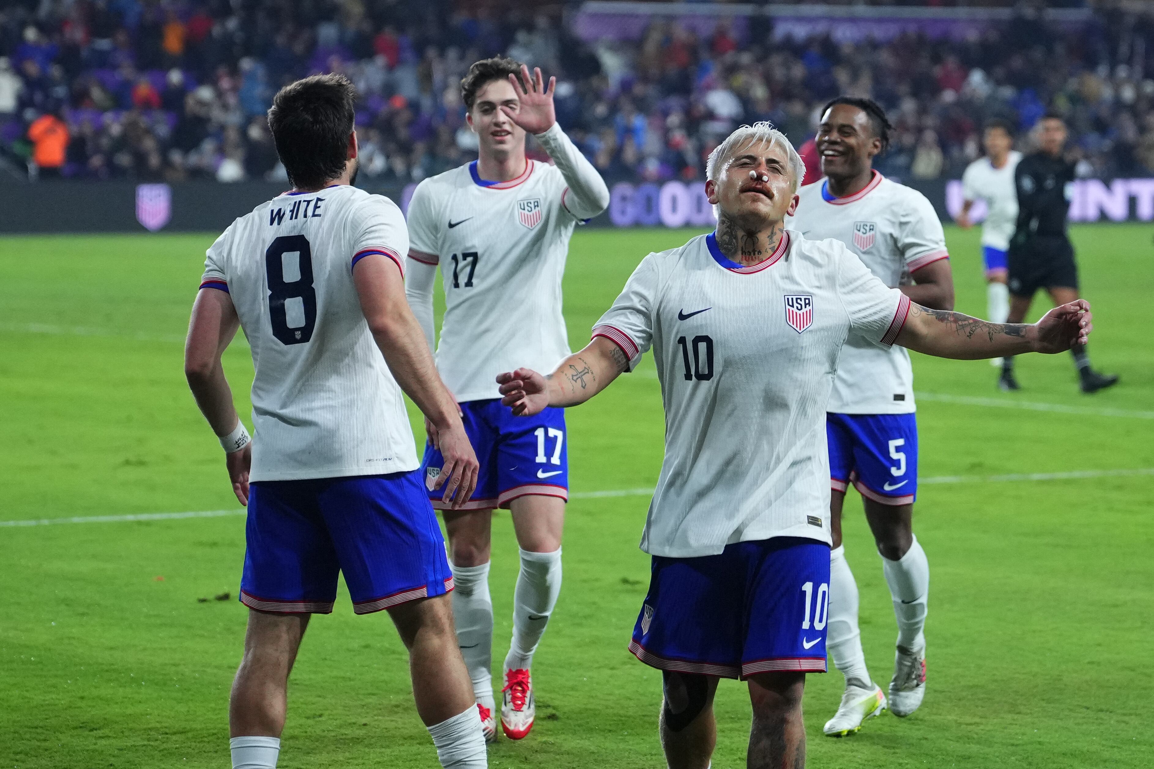 Costa Rica v Estados Unidos