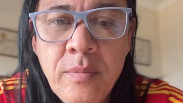 Cantante Erick León se sometió a una operación un poco delicada que le cambiará la vida