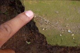 El estremecedor relato de forense que encontró más de 15 agujas dentro de bebé que fue agredido hasta morir