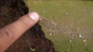 El estremecedor relato de forense que encontró más de 15 agujas dentro de bebé que fue agredido hasta morir