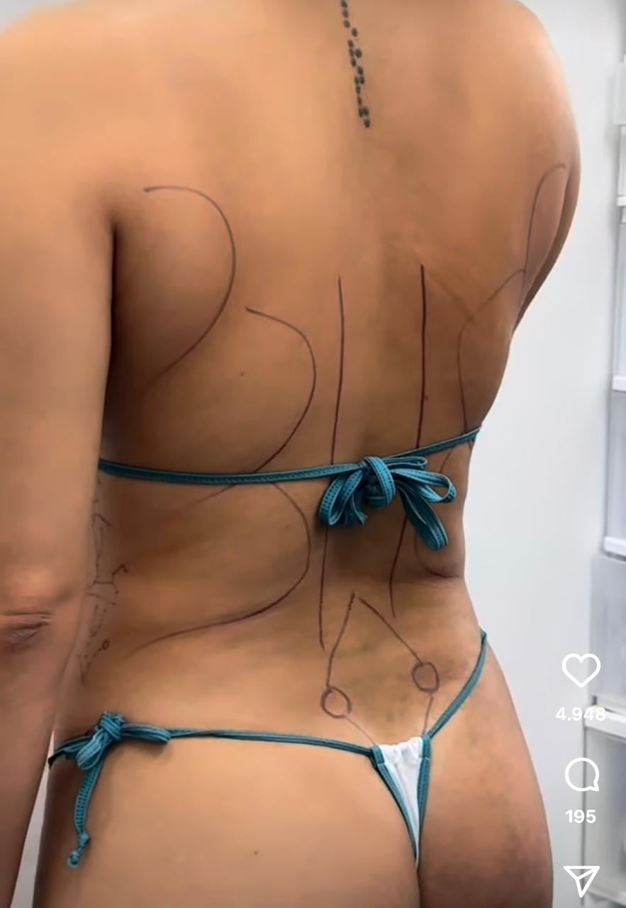 Majo Ulate compartió este miércoles un video con imágenes inéditas de la cirugía estética a la que se sometió hace 11 días y mostró el difícil momento que vivió antes de entrar al quirófano.