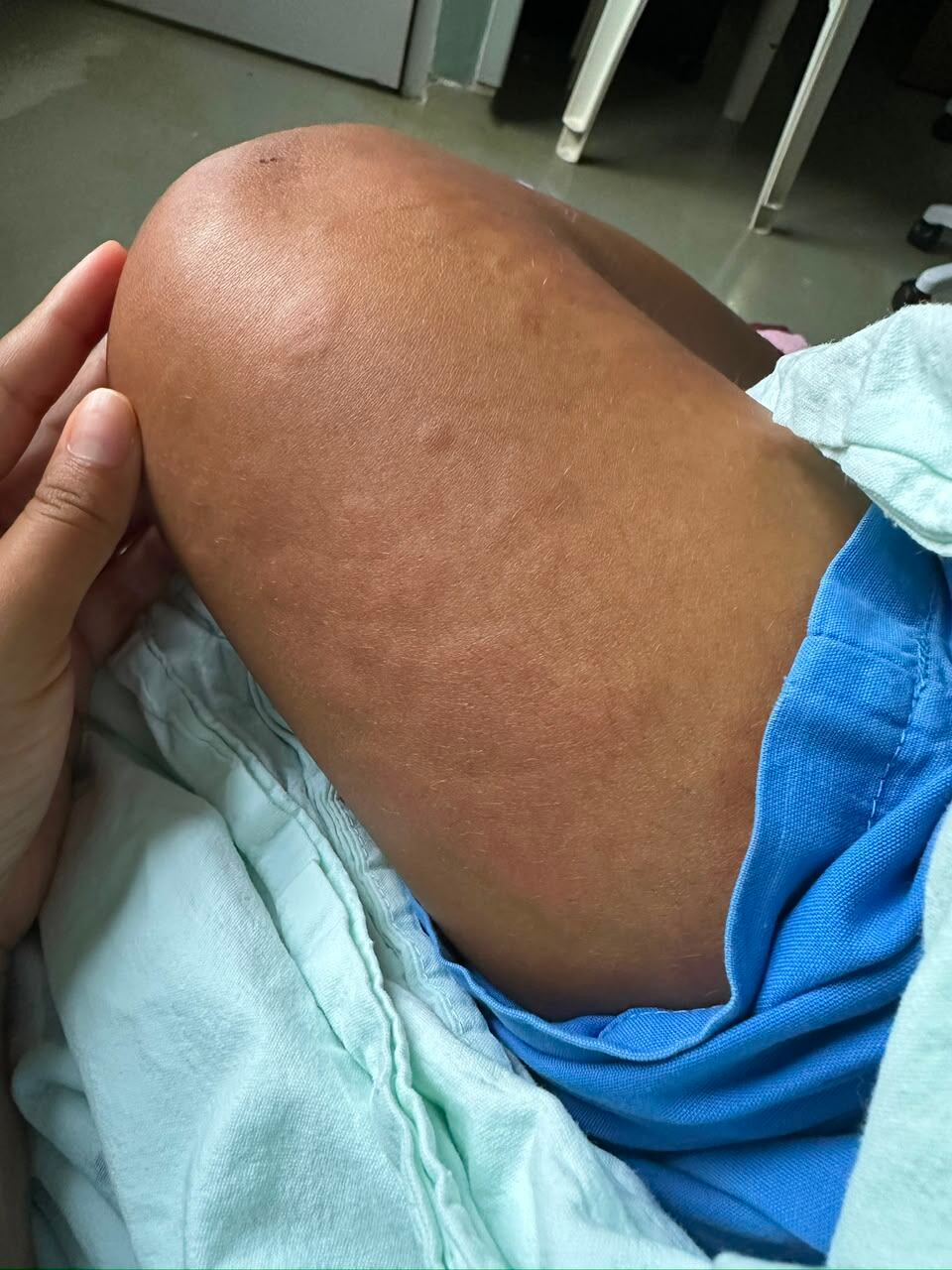 Abril Castillo tuvo un giro en su vida tras mordedura de serpiente