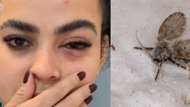 Joven tuvo contacto con mosca mientras se bañaba y lo que le pasó es de espanto: “En segundos empezó a hincharse mucho”