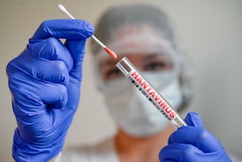 Experto aclara si el hantavirus requiere uso de mascarillas o alcohol en gel