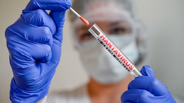 Experto aclara si el hantavirus requiere uso de mascarillas o alcohol en gel