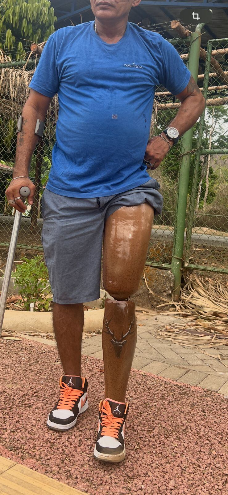 Yeison Silva, de origen nicaragüense, fabrica prótesis para personas amputadas.