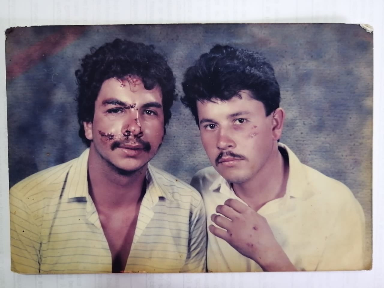 Édgar Cartín Rivera, El Galán, sufrió un accidente de tránsito en 1986, en el cruce de la  muerte en Taras de Cartago. En la foto lo acompaña Óscar Siles (derecha)