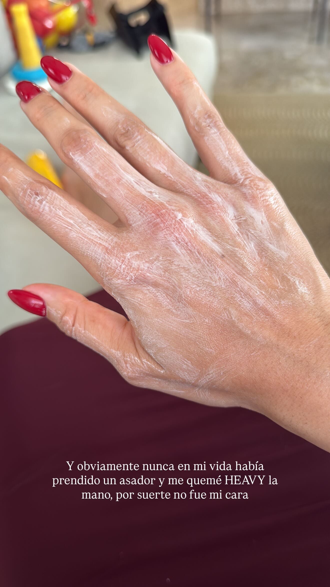 Laura Ortega agradeció que a su cara no le pasó nada con el feo y doloroso accidente que sufrió la noche de este jueves.