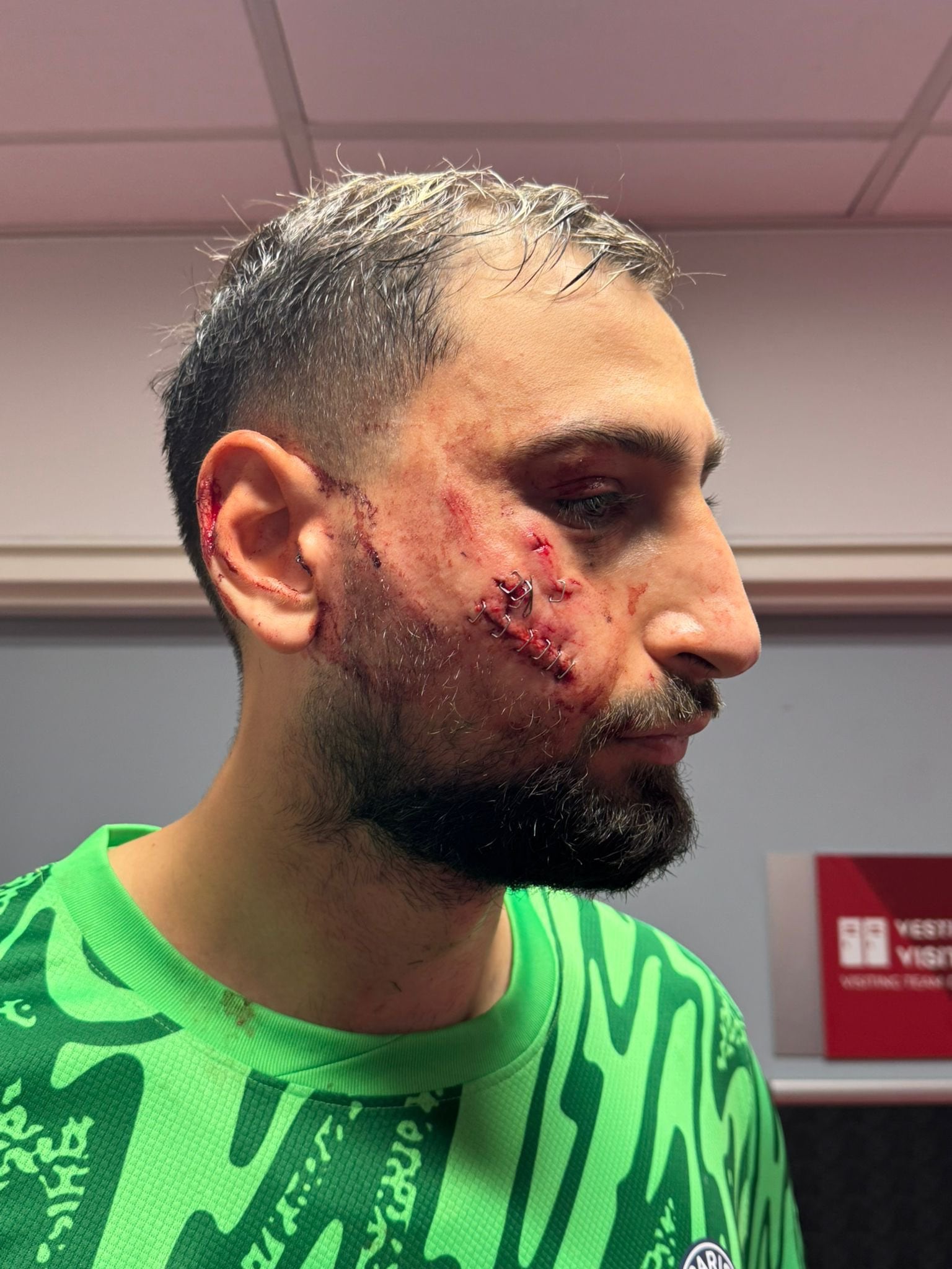 Gianluigi Donnarumma sufrió una falta brutal este miércoles en Francia. Foto: Twitter