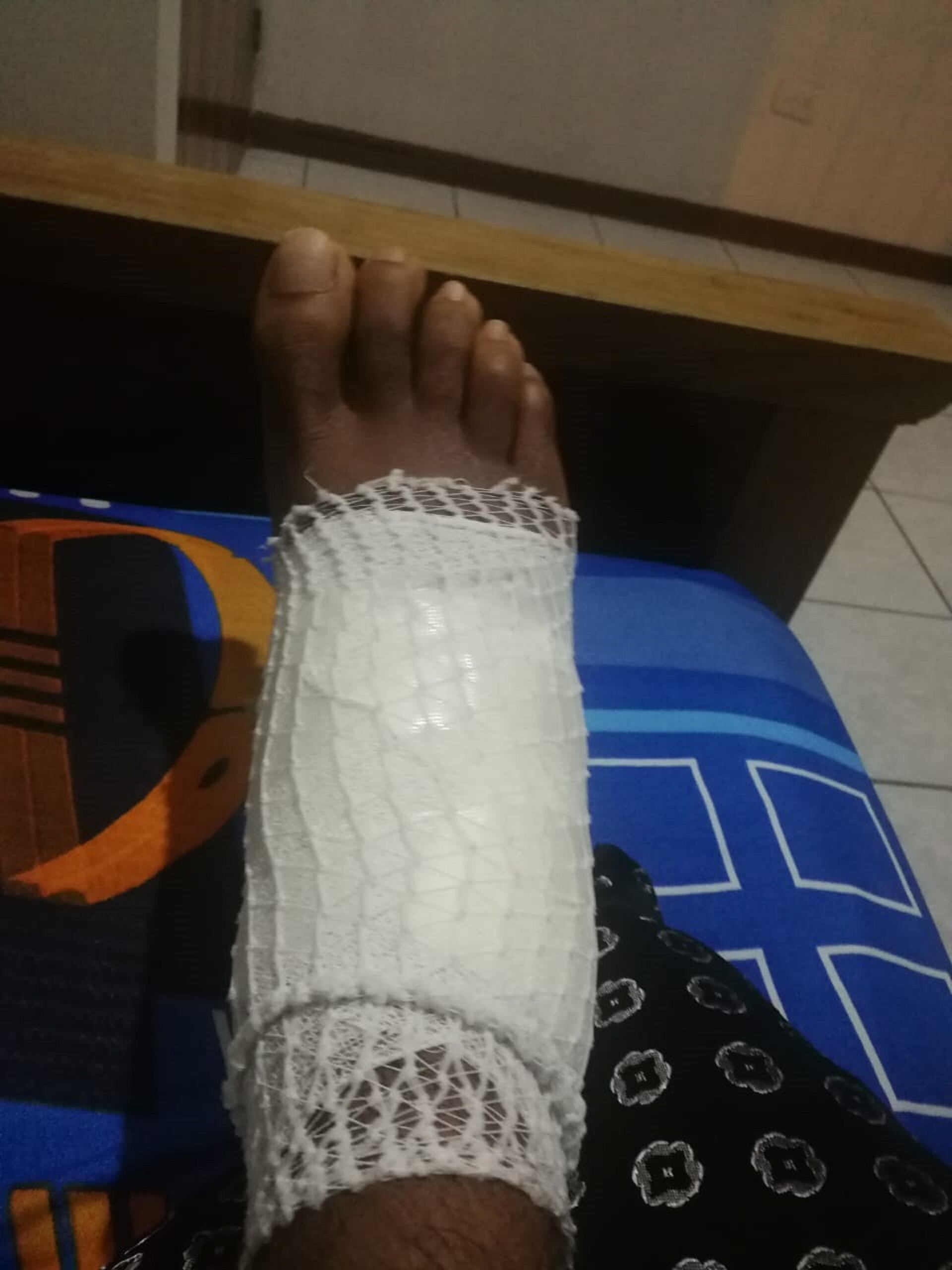 Alexánder Loría: “Por un simple raspón me entró una bacteria y casi me tienen que amputar un pie”