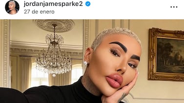 Murió el influencer Jordan James Parke, quien gastó una fortuna para parecerse a Kim Kardashian
