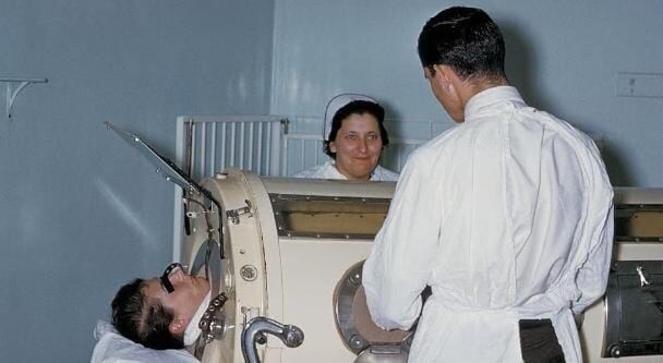 Pulmón de Acero
polio
Paul Alexander