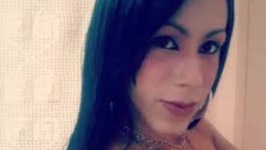 Reconocida influencer vive un infierno con su rostro tras someterse a un tratamiento estético clandestino