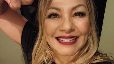 Maricruz Leiva muestra las impactantes cicatrices de su cuerpo y lo que hizo para disimularlas