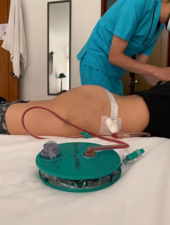 Paola Calderón y su tercera operación de biopolímeros.